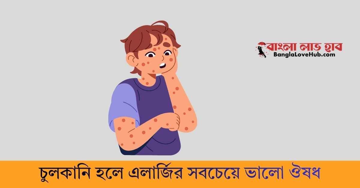 চুলকানি হলে এলার্জির সবচেয়ে ভালো ঔষধ কোনটি