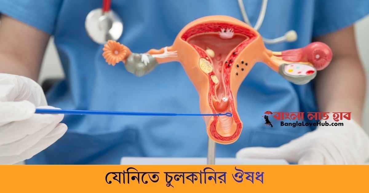 যোনিতে চুলকানি হলে ঔষধ এর নাম কি