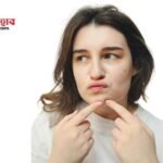 মেয়েদের মুখের ব্রণ ও কালো দাগ দূর করার ক্রিম