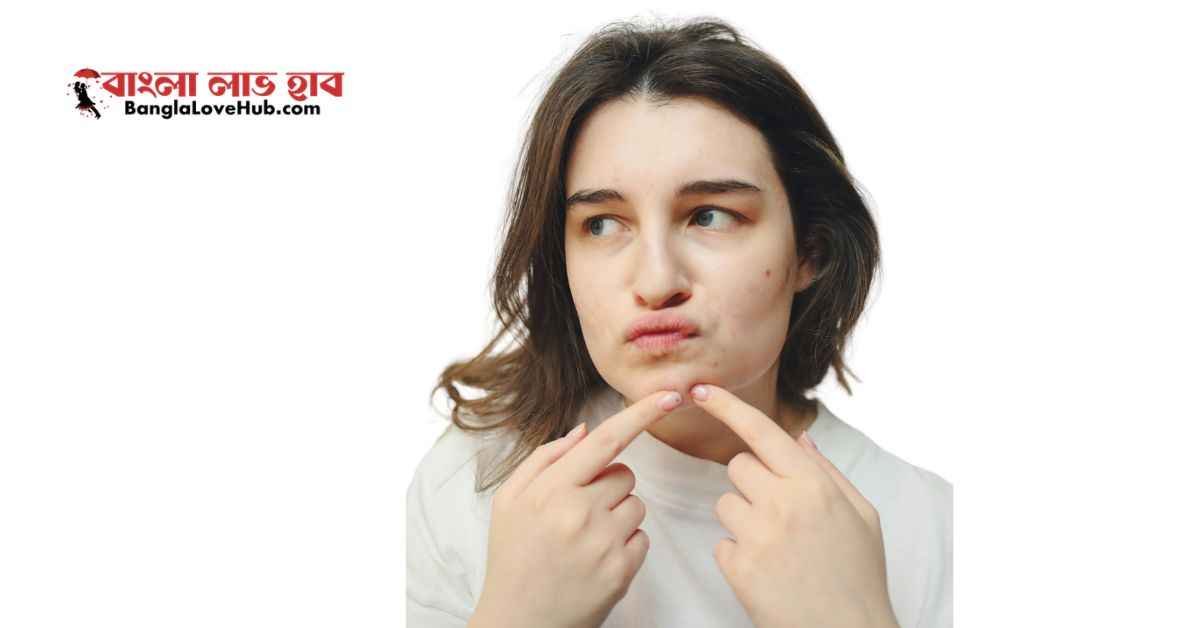 মেয়েদের মুখের ব্রণ ও কালো দাগ দূর করার ক্রিম